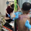 Korban penyiraman air keras ibu dan anak di Sukabumi (foto:Ist)