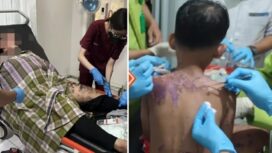 Korban penyiraman air keras ibu dan anak di Sukabumi (foto:Ist)