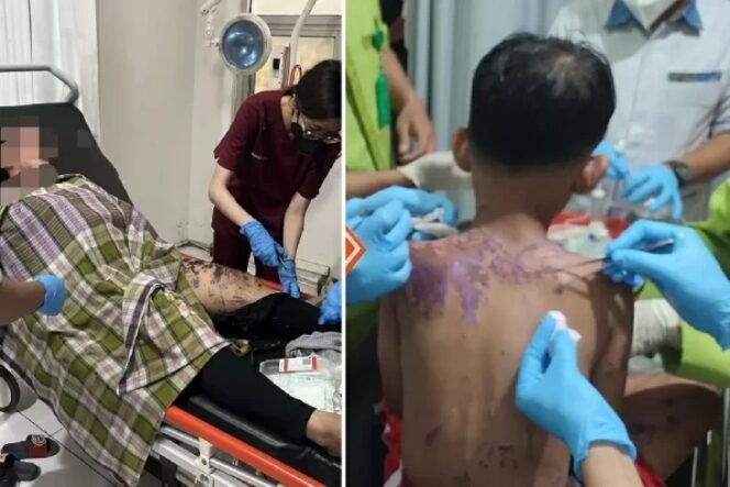 
					Korban penyiraman air keras ibu dan anak di Sukabumi (foto:Ist)