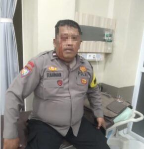 Aipda Abdul Rahman saat mendapatkan perawatan pertama (foto:Ist)