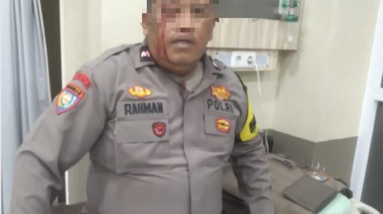 Aipda Abdul Rahman saat mendapatkan perawatan pertama (foto:Ist)