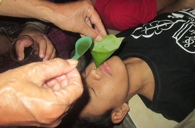 Foto ilustrasi pengobatan alternatif Gurah (foto:Ist)