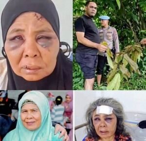 Seorang nenek di Pasaman Timur dianiaya dan dibuang karena menolak tambang emas ilegal di lahan miliknya. Kronologi, kondisi korban, dan upaya hukum.(Istimewa)